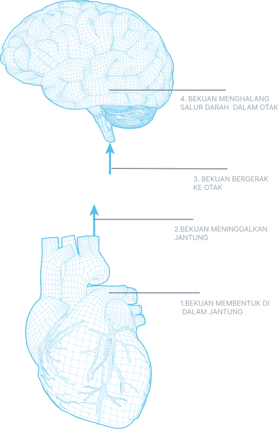 heart and brain image