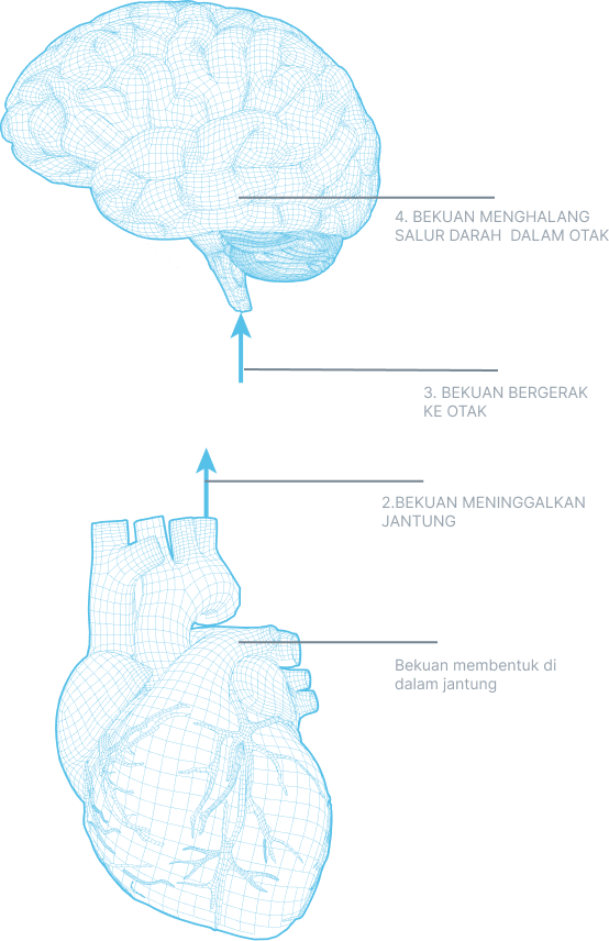 heart and brain image